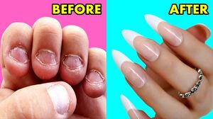 How To GROW Long Strong Nails Fast At Home - DIY Making Nails Strengthener Serum with home materials